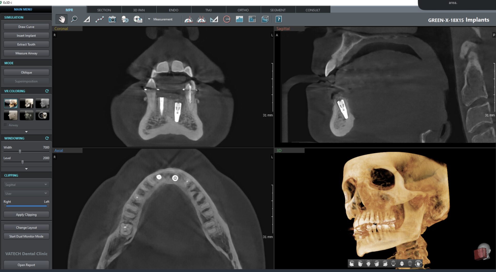Dental X-ray and 3D skull rendering.