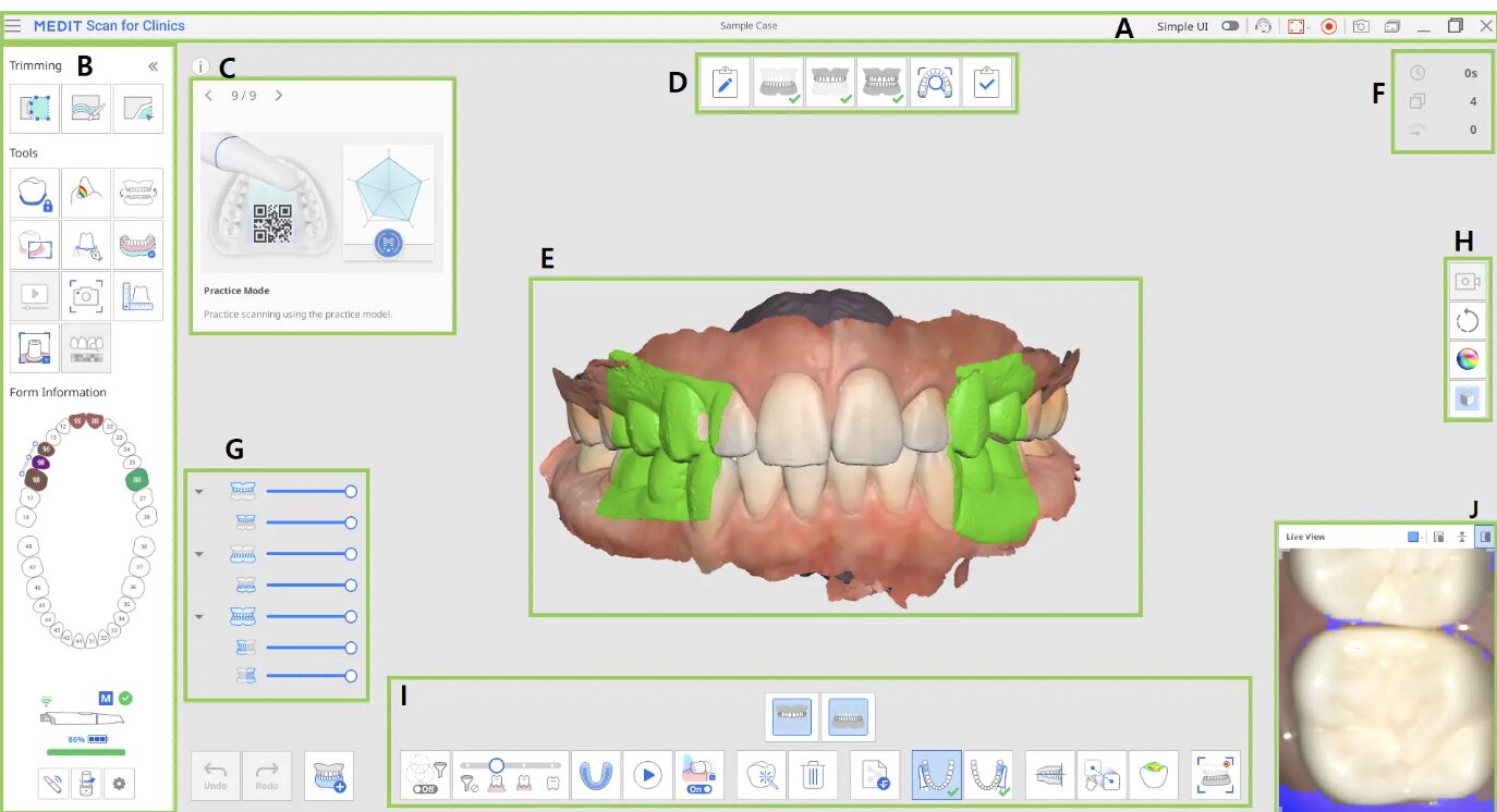 Dental software interface showing 3D teeth model.